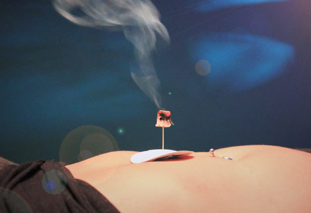 Moxibustion